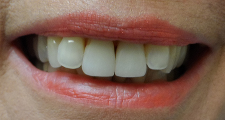 before dental procedure from S Dental & Specialties 2
