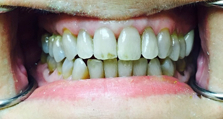 before dental procedure from S Dental & Specialties 1